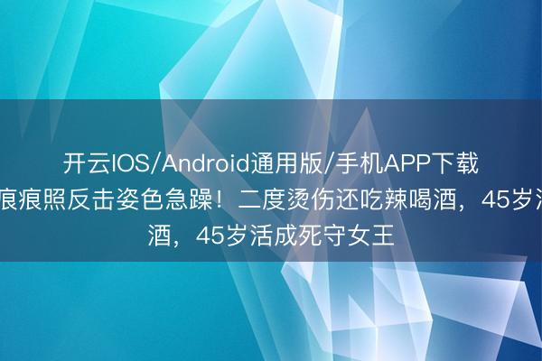 开云IOS/Android通用版/手机APP下载 杨蓉晒烫伤痕痕照反击姿色急躁!二度烫伤还吃辣喝酒,45岁活成死守女王